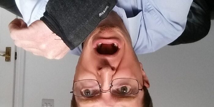 John Allen with injured hand in wrist support